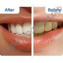 Отбеливающие полоски для зубов CREST WHITESTRIPS 3D